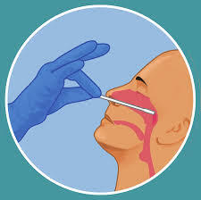 Nasal Swab